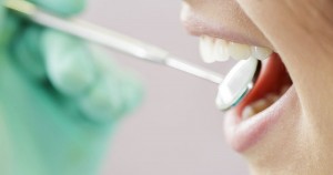 Missfärgade tänder och tandblekning