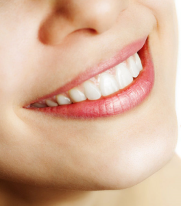 tandstens borttagning