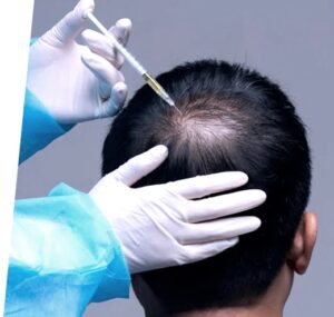 Hairfiller man