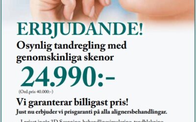 Osynlig tandreglering